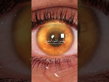 والله بالله  | حسين الضوة البالعين