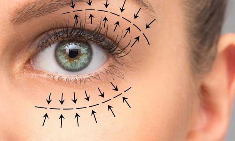 كل ما تحتاجين معرفته عن عملية تجميل الجفون (بلفاروبلاستي)