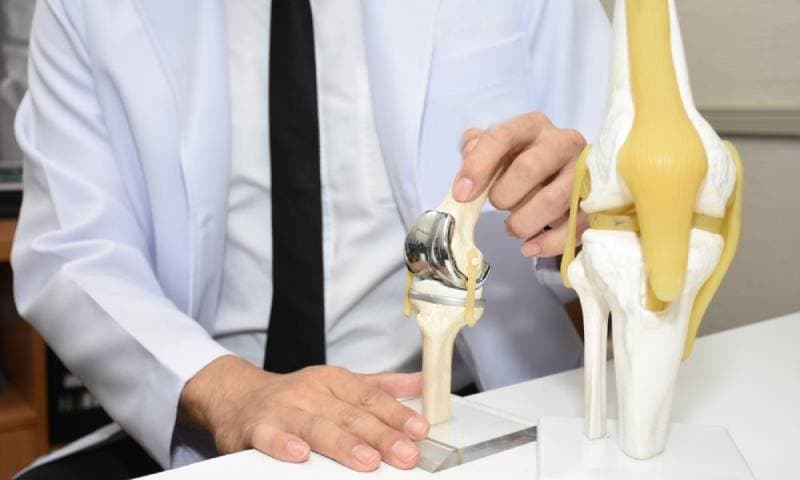 استبدال مفصل الركبة: دليل شامل للعملية وفوائدها