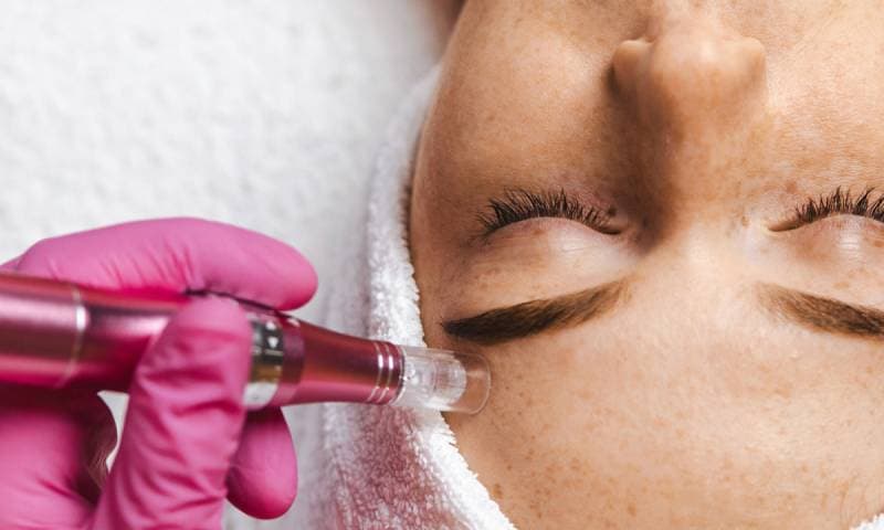 المايكرونيدلينغ Microneedling والهايفو HIFU: سرّان حديثان في عالم شباب البشرة